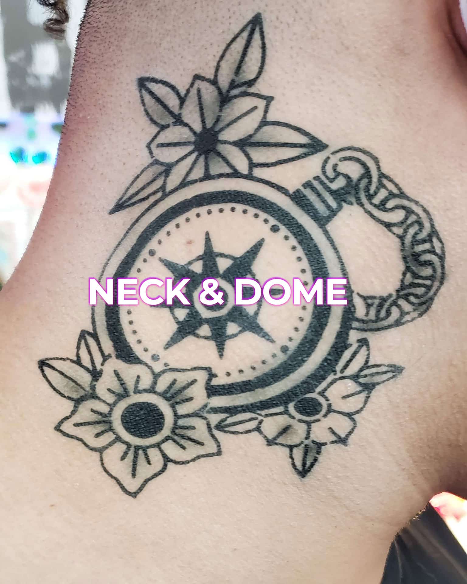 neck dome TITLE